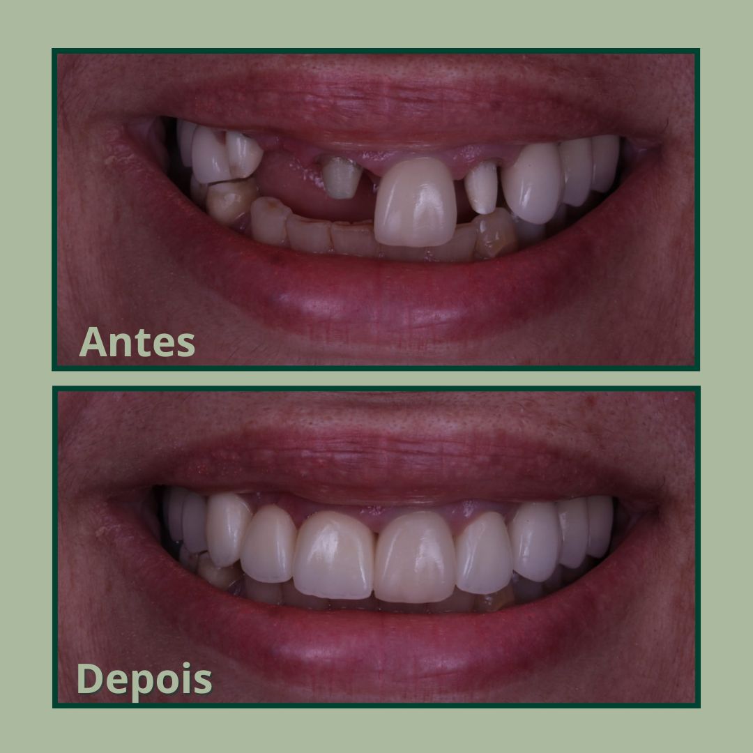 Cópia de Post para instagram de odontologia moderno verde e branco (1)