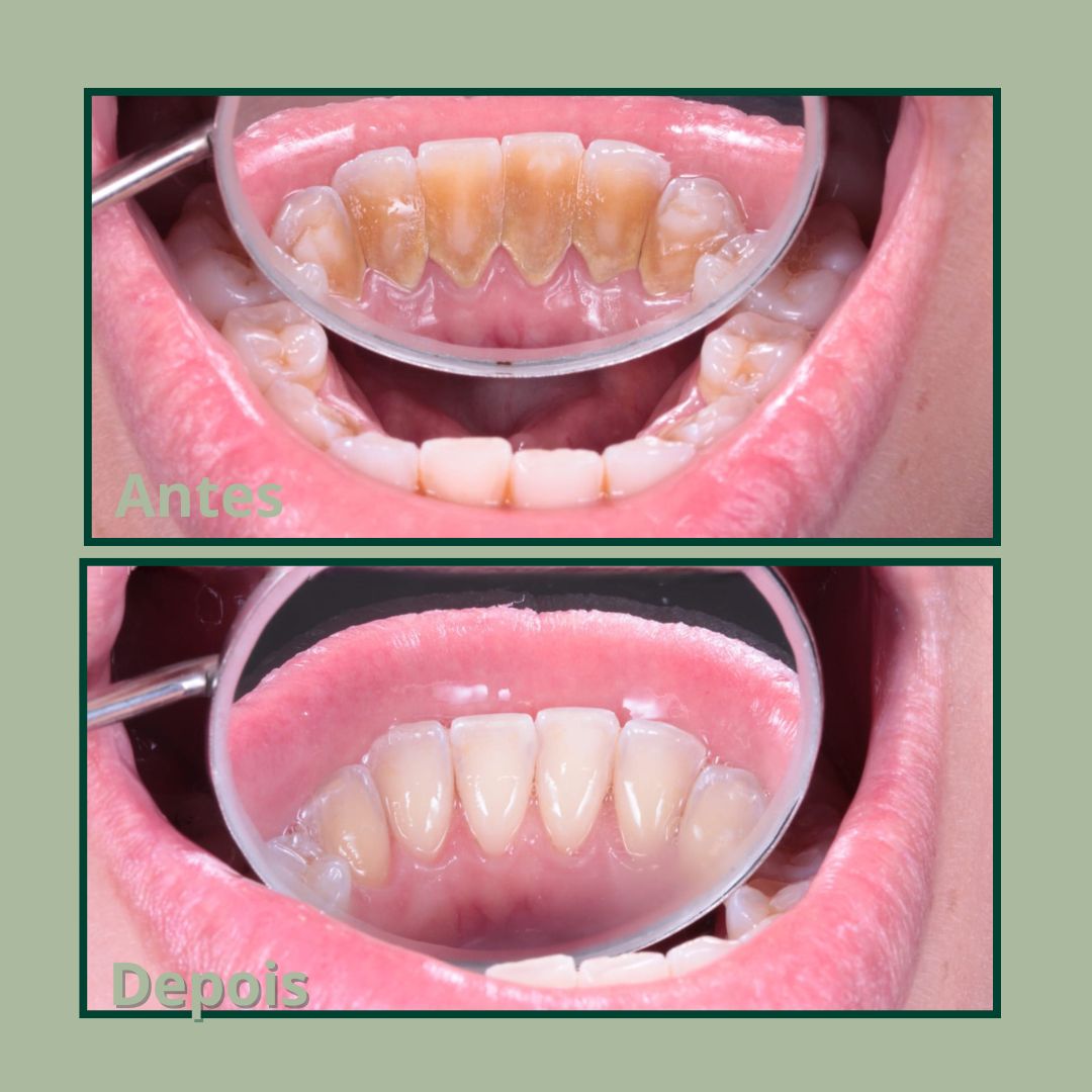 Cópia de Post para instagram de odontologia moderno verde e branco (2)