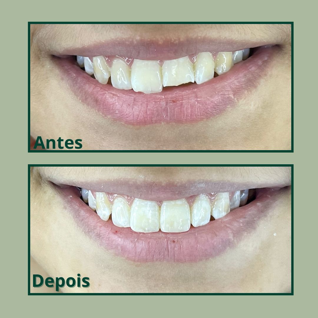 Cópia de Post para instagram de odontologia moderno verde e branco (4)