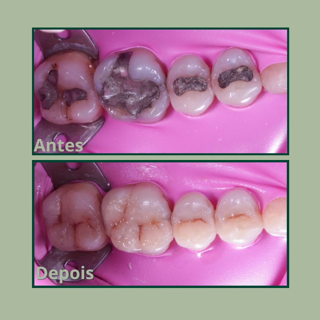 Cópia de Post para instagram de odontologia moderno verde e branco